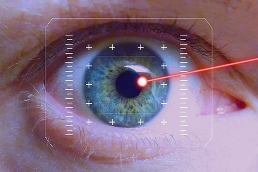 Eye surgery in Sydney