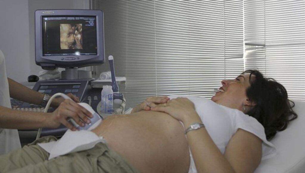 3D Ultrasound