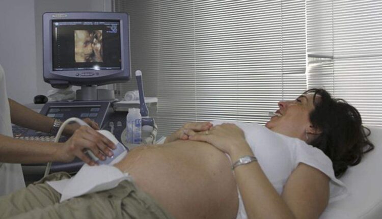3D Ultrasound