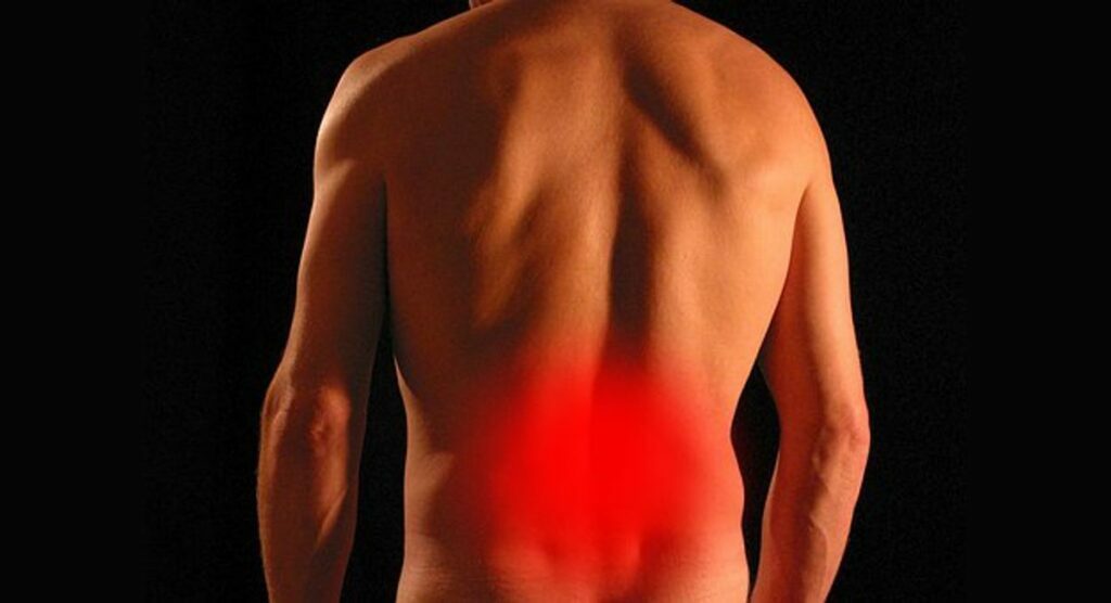 What Is Fibromyalgia Pain Syndrome