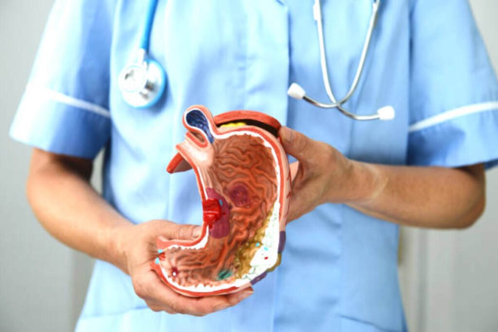 colitis