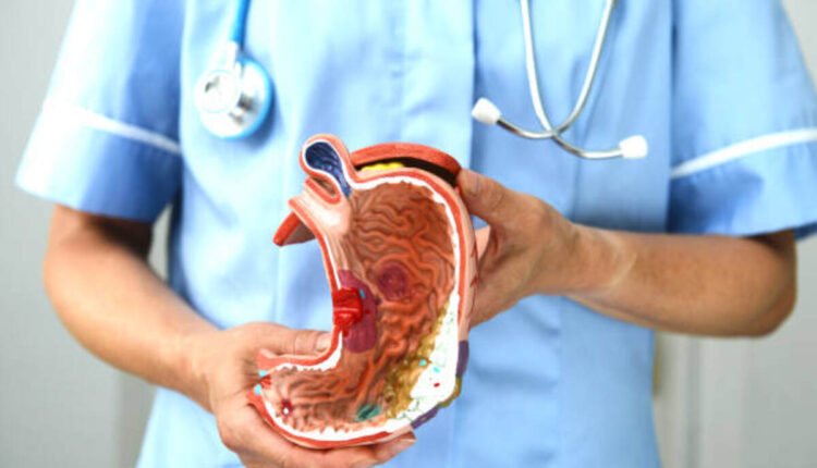 colitis