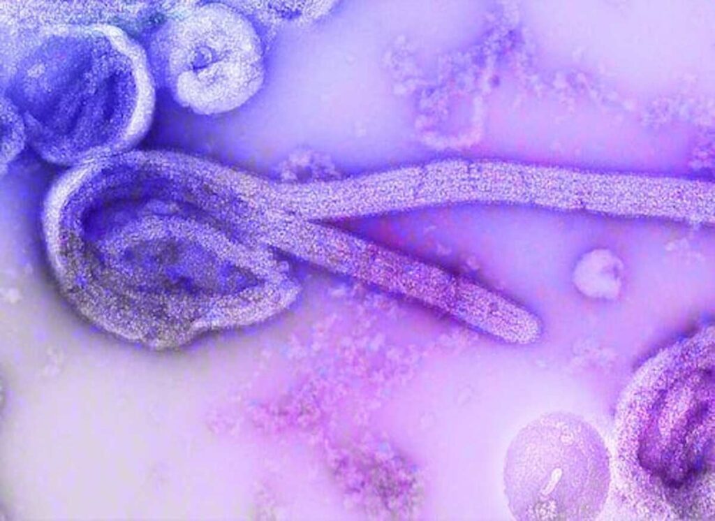 ebola