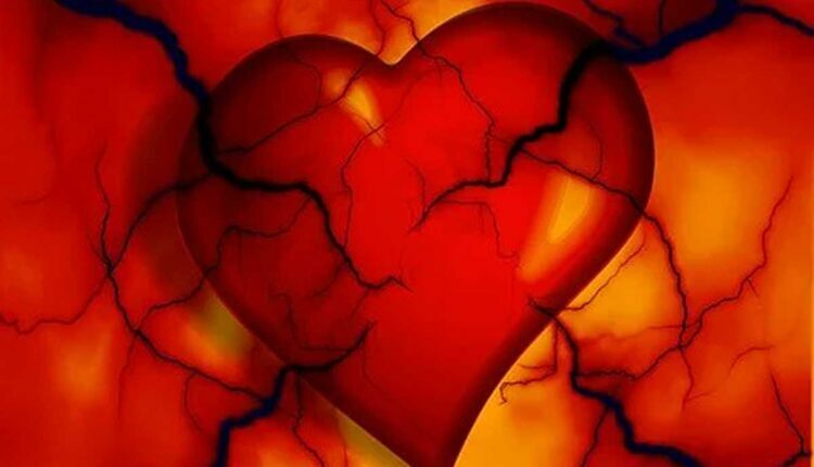 Heart and Artery (Cardiovascular) Problems