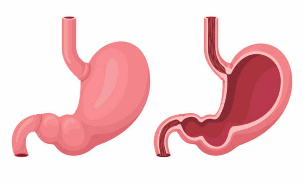 london gastro care