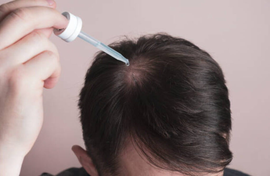 Mens Guide to Hair Restoration Alternatives